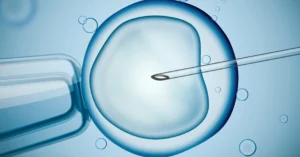 IVF Treatment