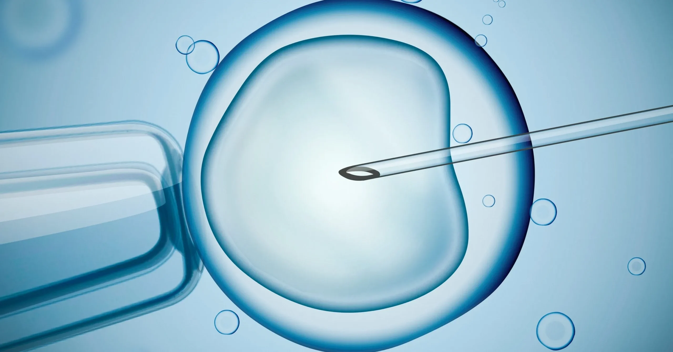 IVF Treatment