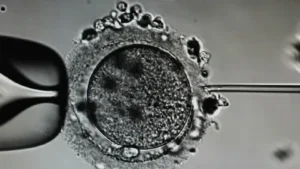 ICSI procedure in fertility lab
