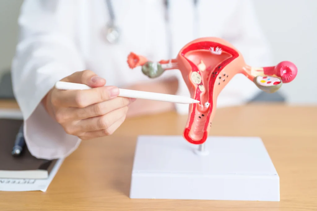 IUI Treatment in Lahore, Pakistan